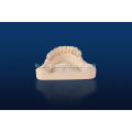 zirconia porcelain fused ກັບເຮືອນຍອດໂລຫະ